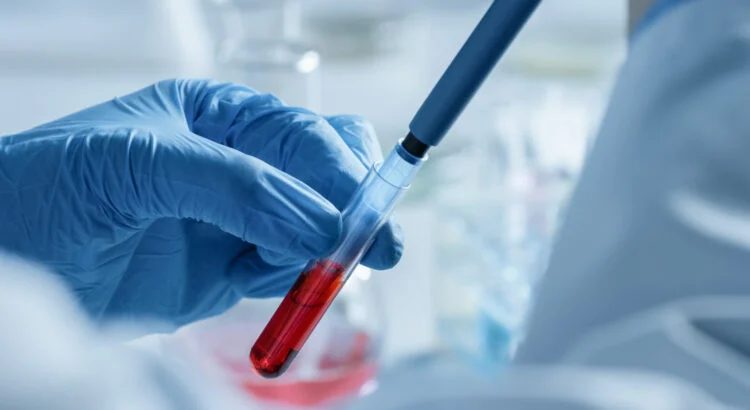 Crise cardiaque : voici ce que les chercheurs ont retrouvé dans le sang de tous les patients les plus gravement atteints