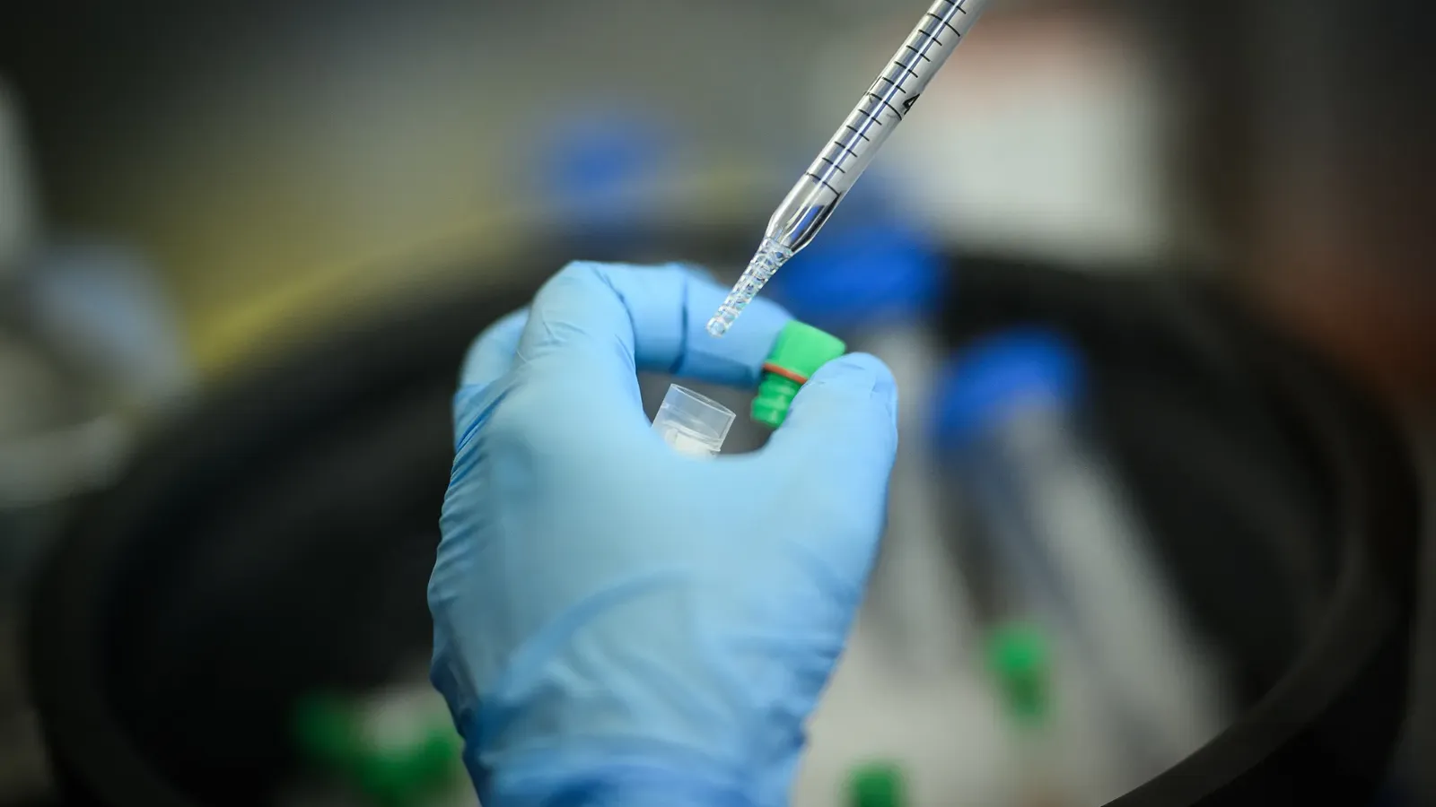Cancer du poumon: un vaccin prometteur à l'essai dans sept pays