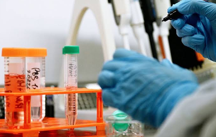 Les Etats-Unis restreignent la recherche sur les virus