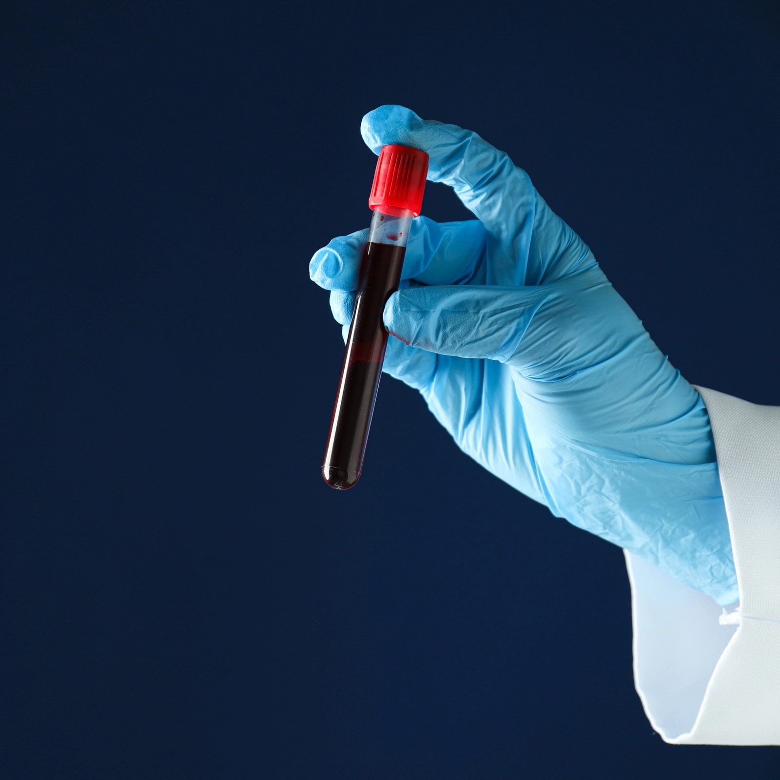 Un nouveau test permettrait une détection précoce du cancer à partir de minuscules particules présentes dans les fluides corporels