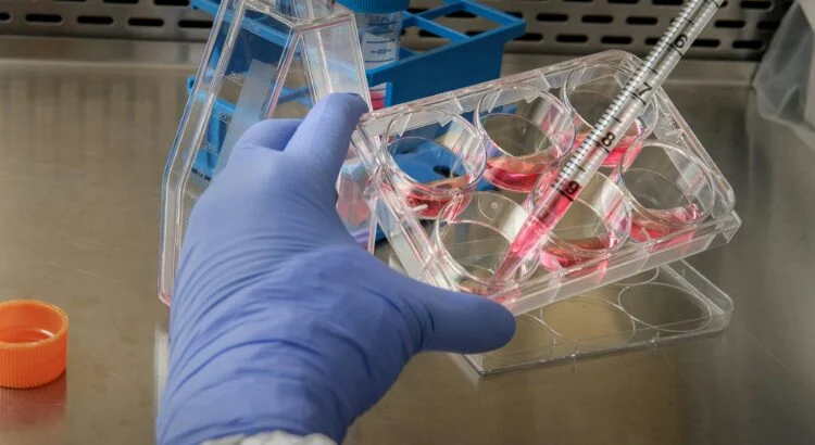 Cancer : ce traitement expérimental a fait disparaître la métastase d'un enfant de trois ans ...