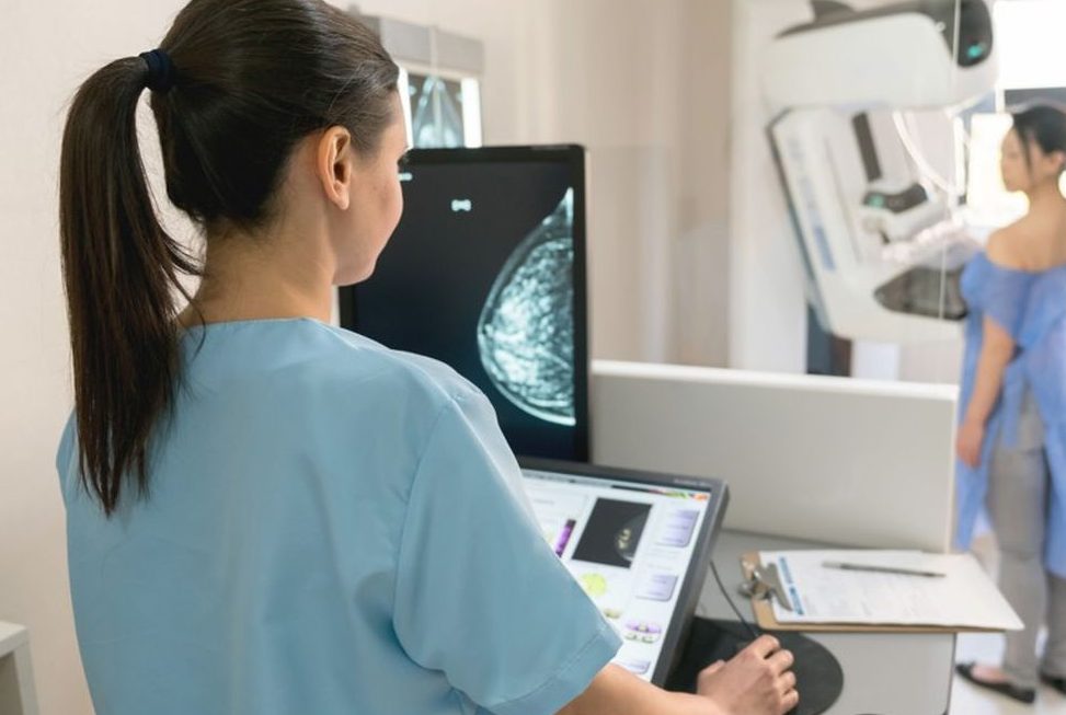 Cancer du sein : Les spécialistes plaident pour un parcours de soins coordonné